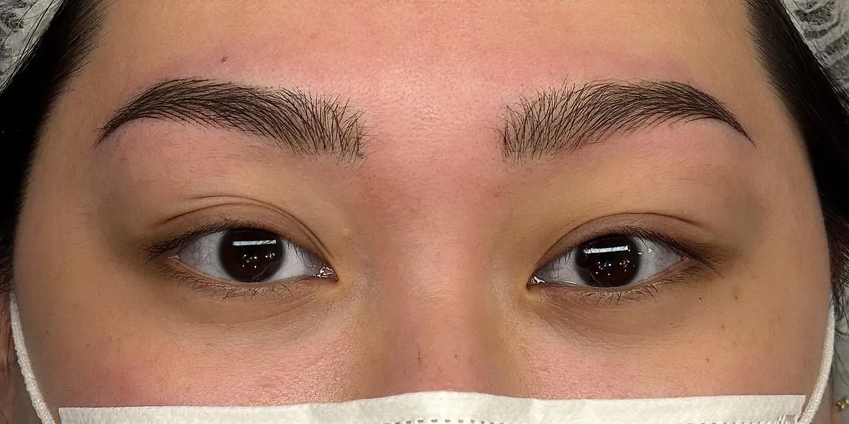 After: the same client with Nano Brows, masked