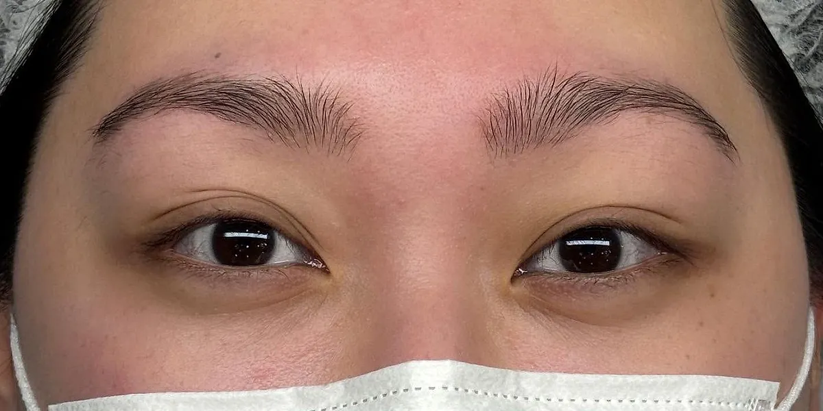 Before: client's brows before Nano Brows, masked