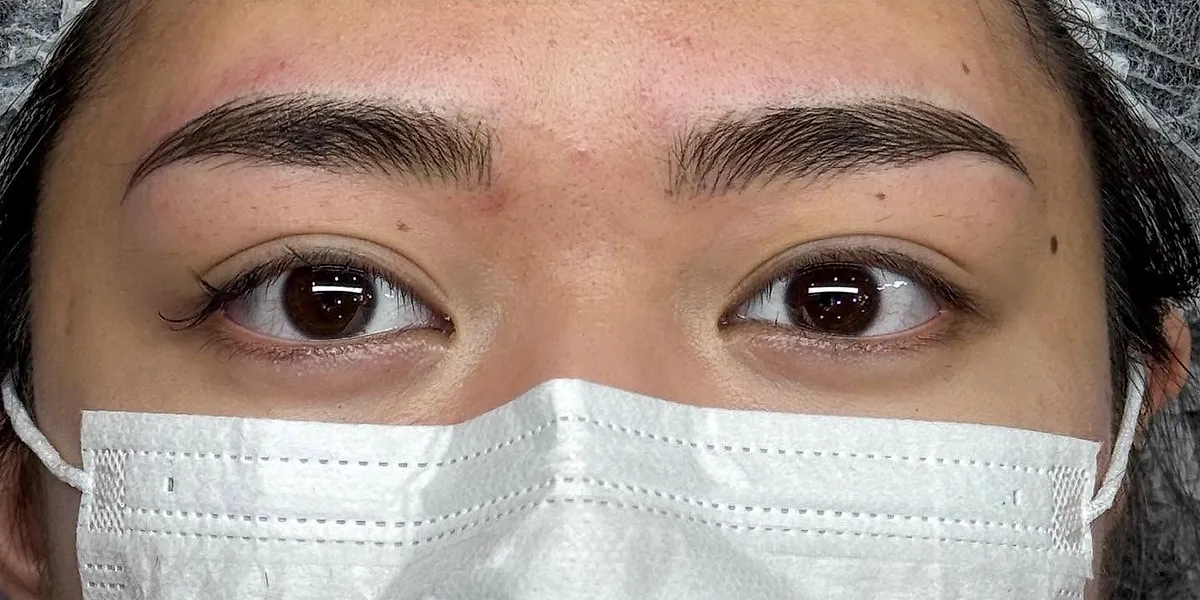 After: the same client with Nano Brows, masked