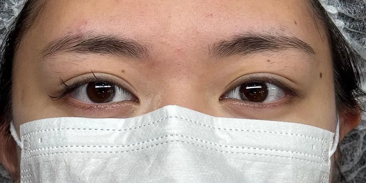 Before: client's brows before Nano Brows, masked