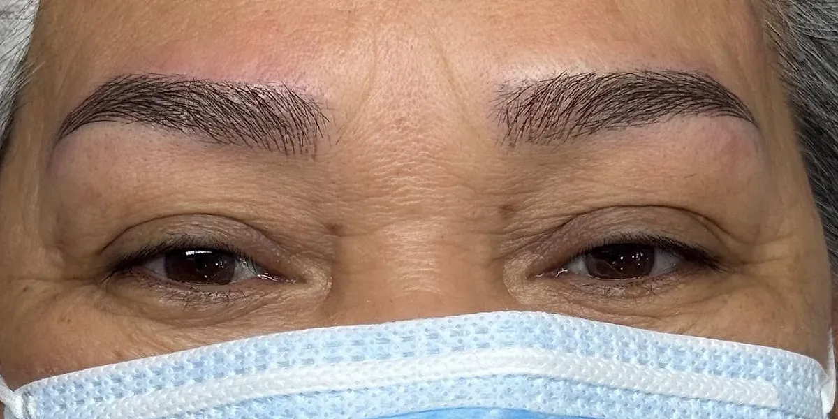 After: the same client with Nano Brows, masked