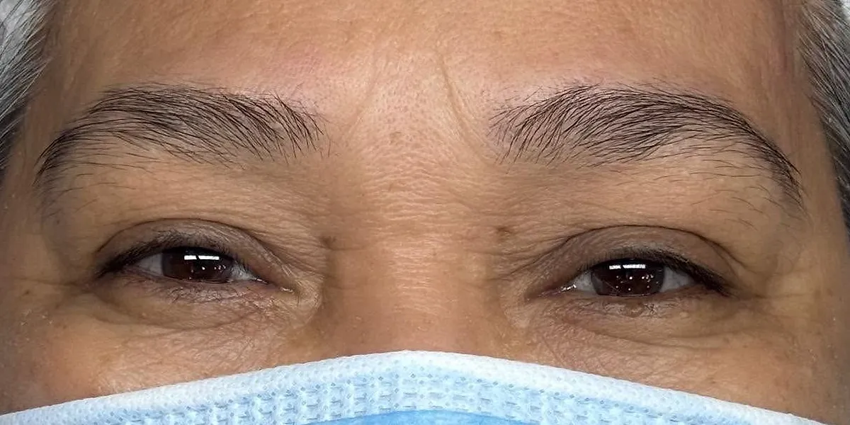 Before: client's brows before Nano Brows, masked