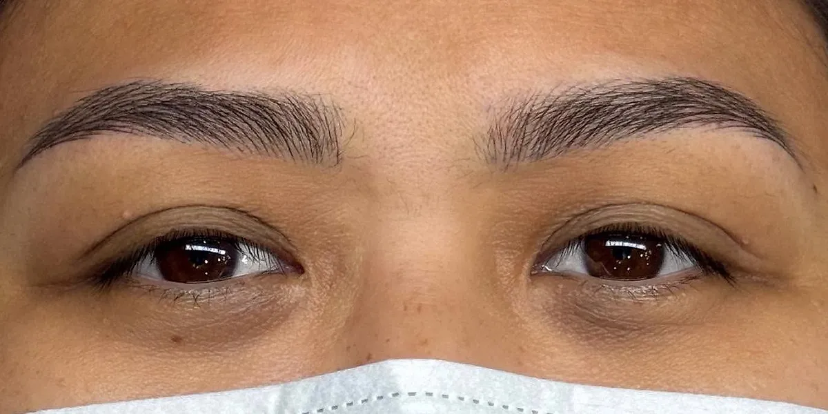 After: the same client with Nano Brows, masked