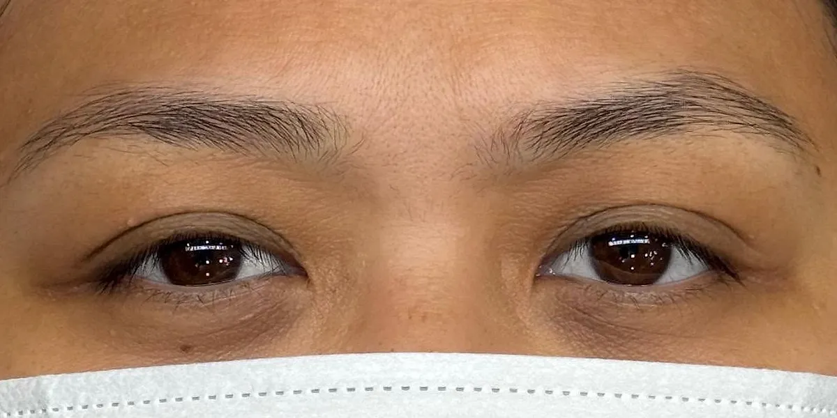 Before: client's brows before Nano Brows, masked
