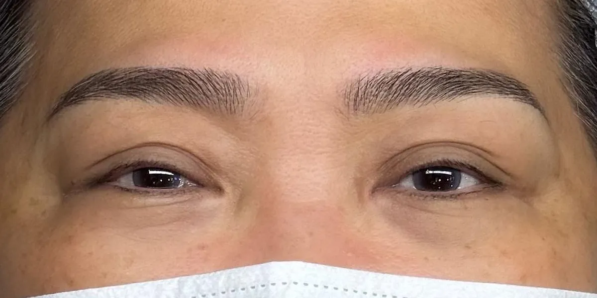 After: the same client with Nano Brows, masked