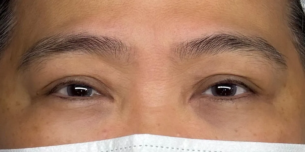 Before: client's brows before Nano Brows, masked